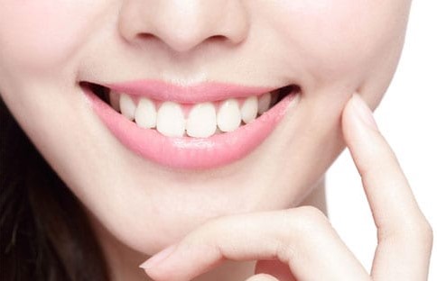 Mengenal Veneer Gigi Kelinci dan Prosedurnya